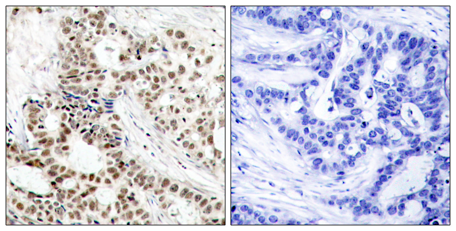 Anti-Phospho-BRCA1 (Ser1423) Rabbit Polyclonal Antibody