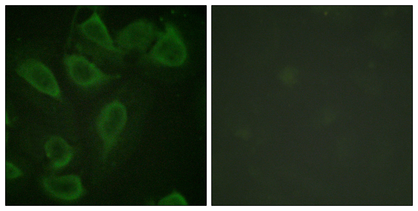 Anti-Phospho-CD31 (Tyr713) Rabbit Polyclonal Antibody