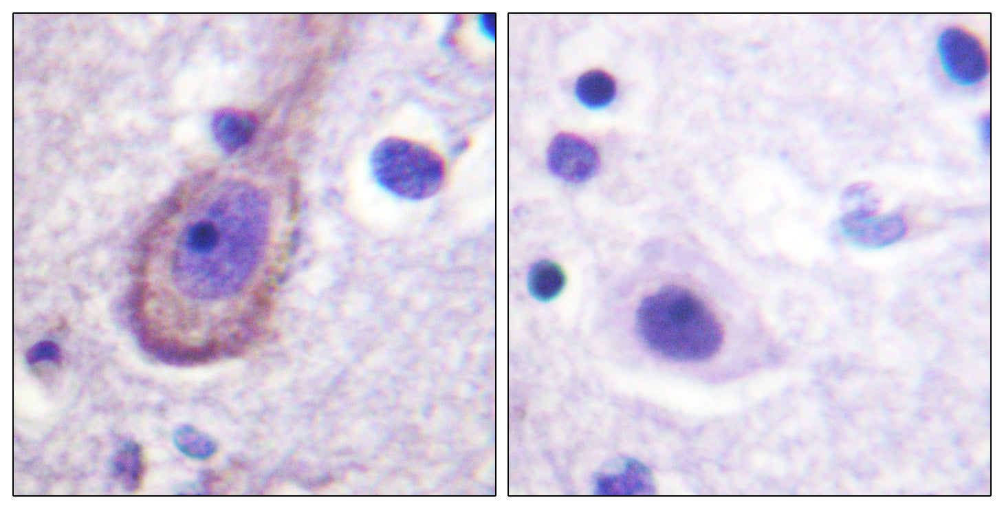 Anti-Phospho-KCNQ2/3/4/5 (Thr217/Thr246/Thr223/Thr251) Rabbit Polyclonal Antibody