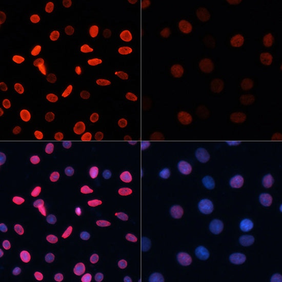 Anti-Acetyl-Histone H2B (Lys5) Rabbit Polyclonal Antibody