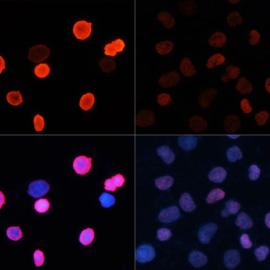 Anti-Acetyl-Histone H2B (Lys5) Rabbit Polyclonal Antibody