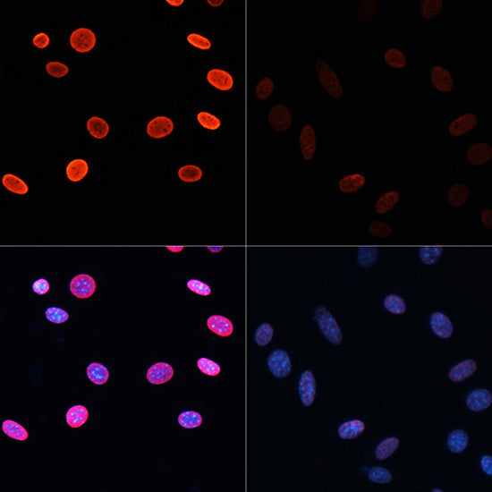 Anti-Acetyl-Histone H2B (Lys5) Rabbit Polyclonal Antibody