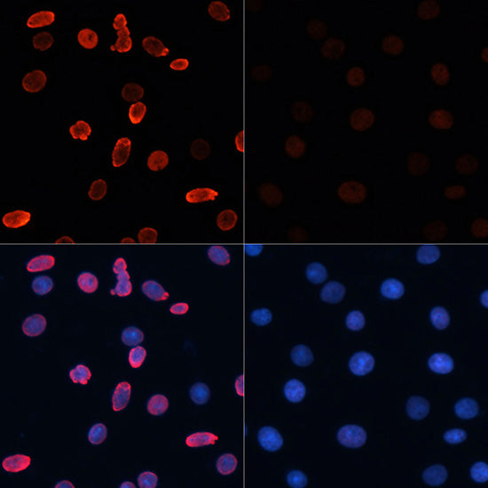 Anti-Acetyl-Histone H2B (Lys15) Rabbit Polyclonal Antibody