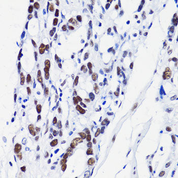 Anti-Acetyl-Histone H2B (Lys15) Rabbit Polyclonal Antibody