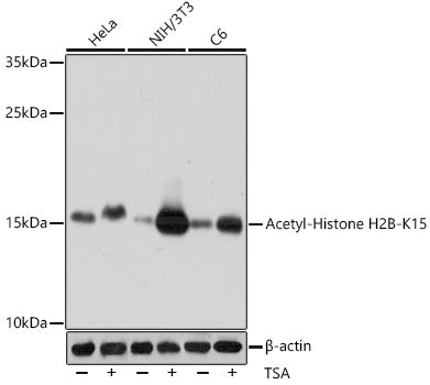 Anti-Acetyl-Histone H2B (Lys15) Rabbit Polyclonal Antibody