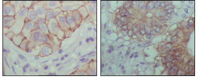 Anti-Ephrin Receptor B1 (9B4) Mouse Monoclonal Antibody