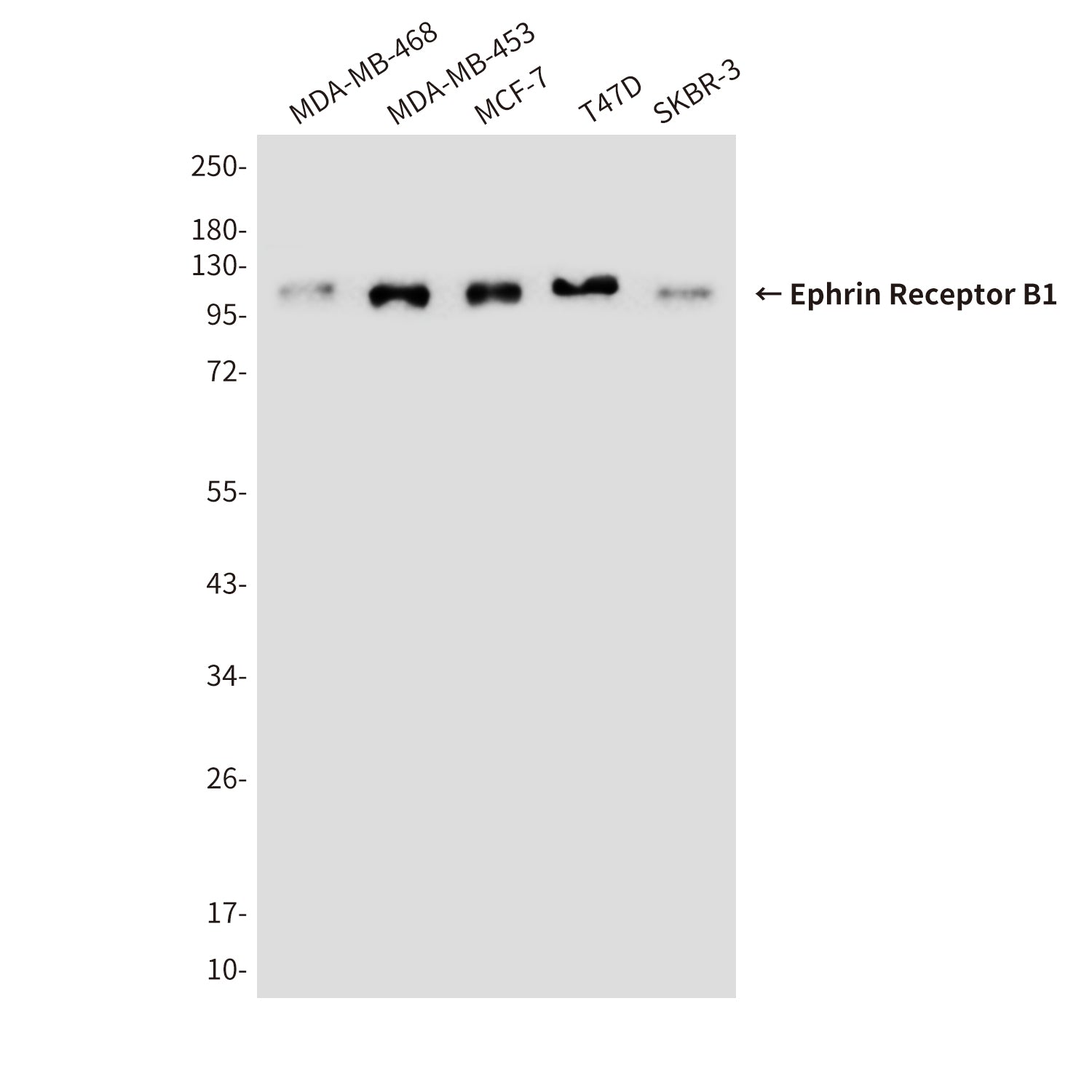 Anti-Ephrin Receptor B1 (9B4) Mouse Monoclonal Antibody