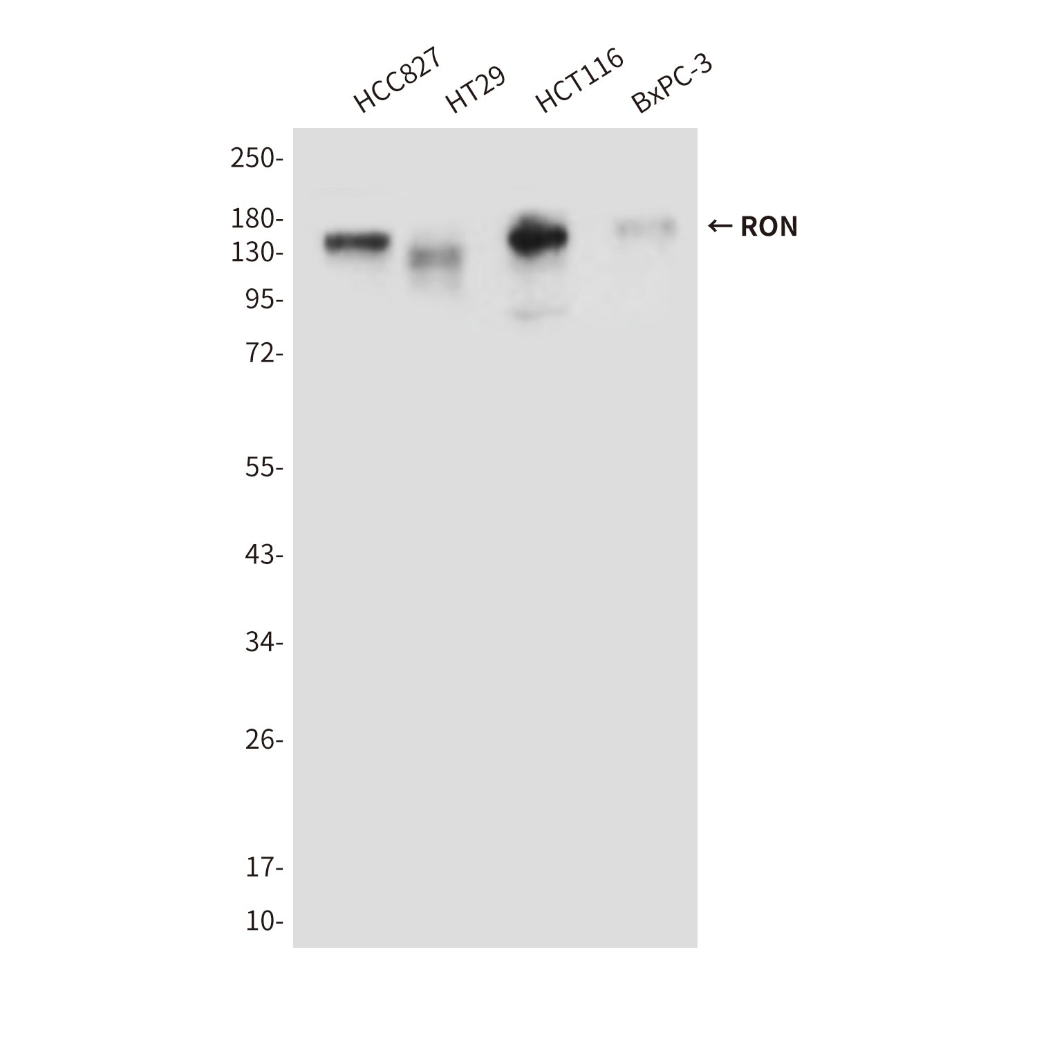 Anti-RON (9B6) Mouse Monoclonal Antibody