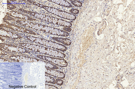 Anti-Cytokeratin 8 (10A5) Mouse Monoclonal Antibody