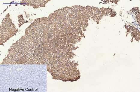 Anti-Cytokeratin 8 (10A5) Mouse Monoclonal Antibody
