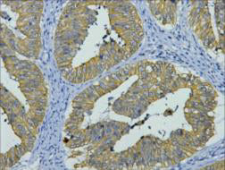 Anti-Cytokeratin 8 (10A5) Mouse Monoclonal Antibody