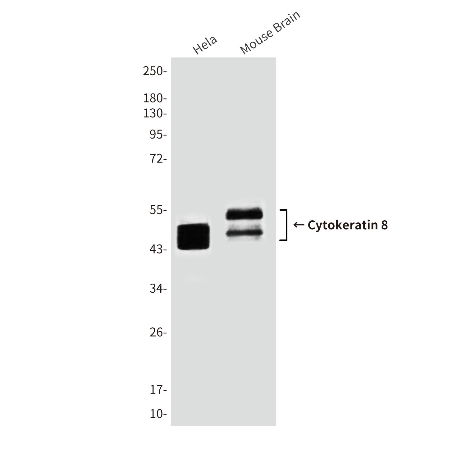 Anti-Cytokeratin 8 (10A5) Mouse Monoclonal Antibody