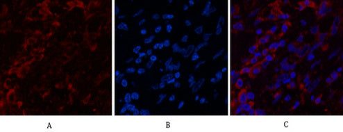 Anti-Cytokeratin 6 (1A5) Mouse Monoclonal Antibody