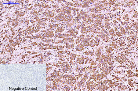 Anti-Cytokeratin 6 (1A5) Mouse Monoclonal Antibody