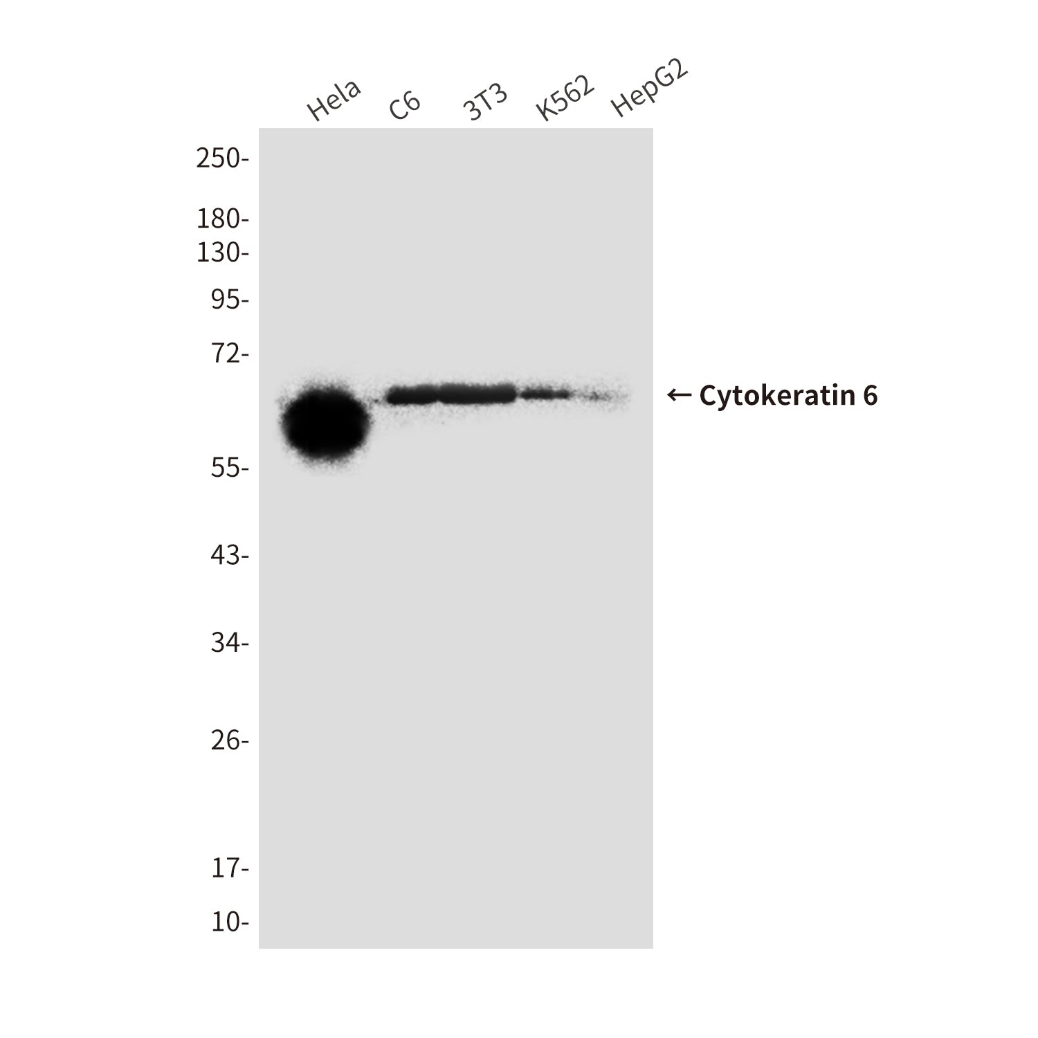 Anti-Cytokeratin 6 (1A5) Mouse Monoclonal Antibody