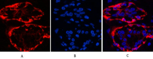Anti-Cytokeratin 17 (8C6) Mouse Monoclonal Antibody