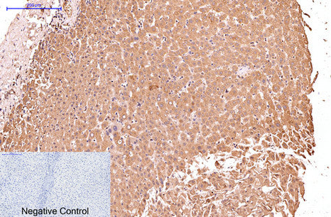 Anti-Cytokeratin 17 (8C6) Mouse Monoclonal Antibody