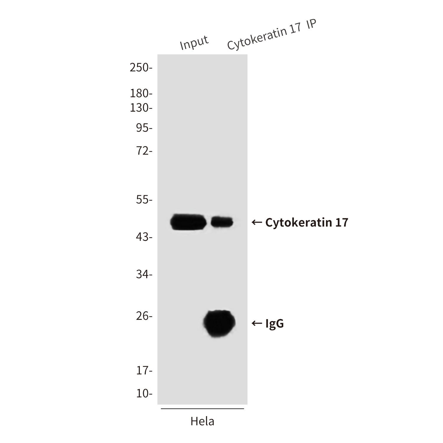 Anti-Cytokeratin 17 (8C6) Mouse Monoclonal Antibody