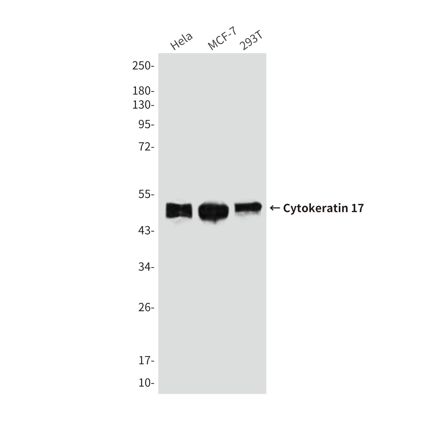 Anti-Cytokeratin 17 (8C6) Mouse Monoclonal Antibody