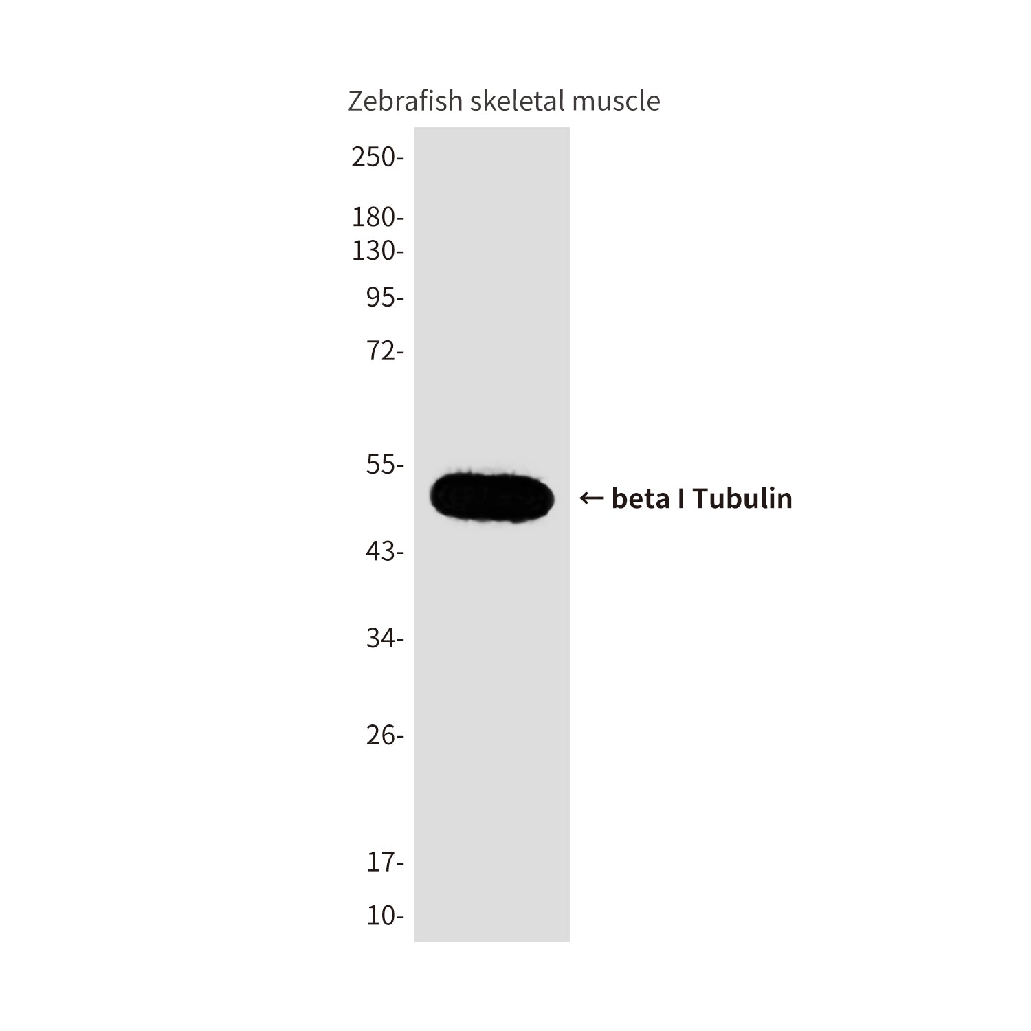 Anti-beta I Tubulin (8E6) Mouse Monoclonal Antibody