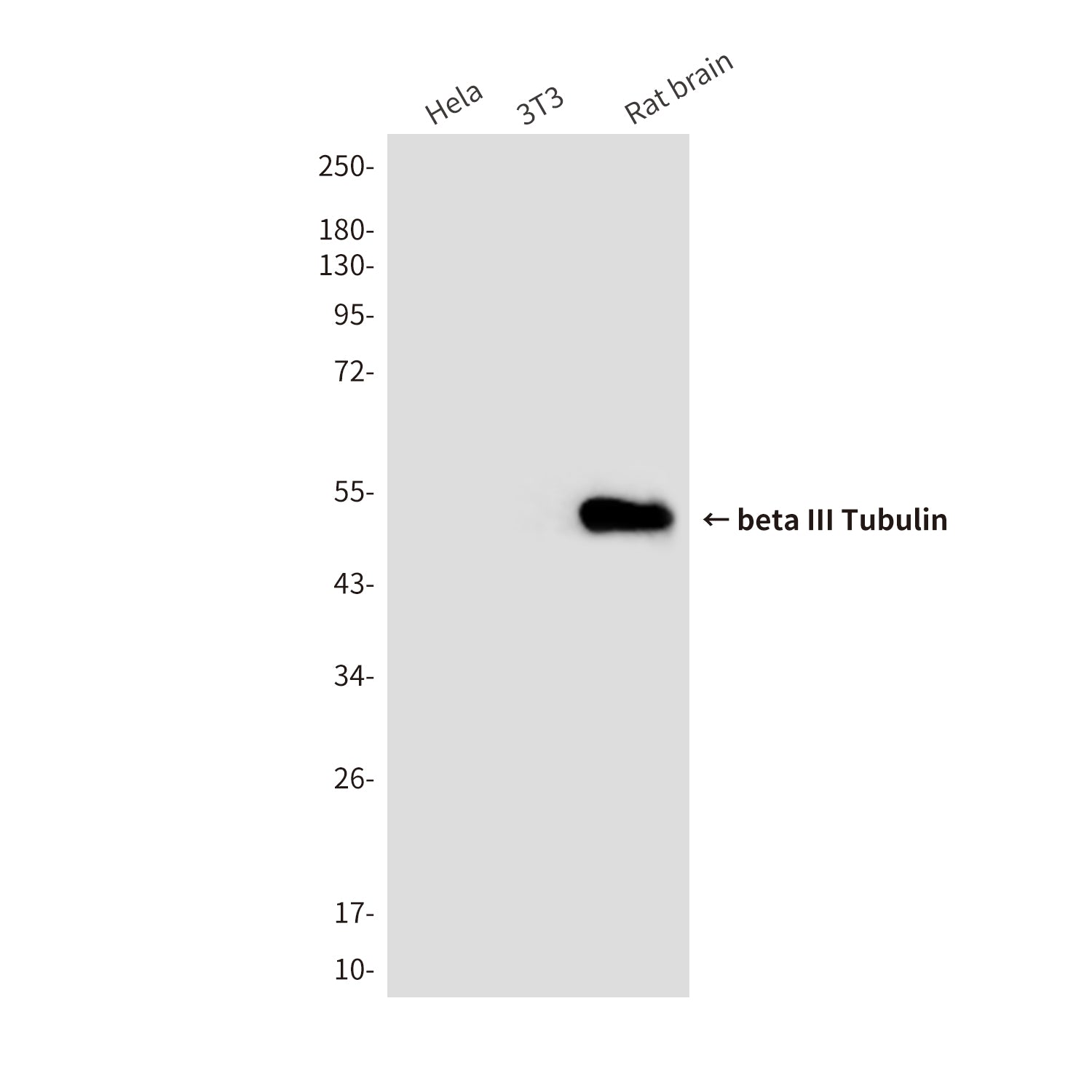 Anti-beta III Tubulin (3H2) Mouse Monoclonal Antibody