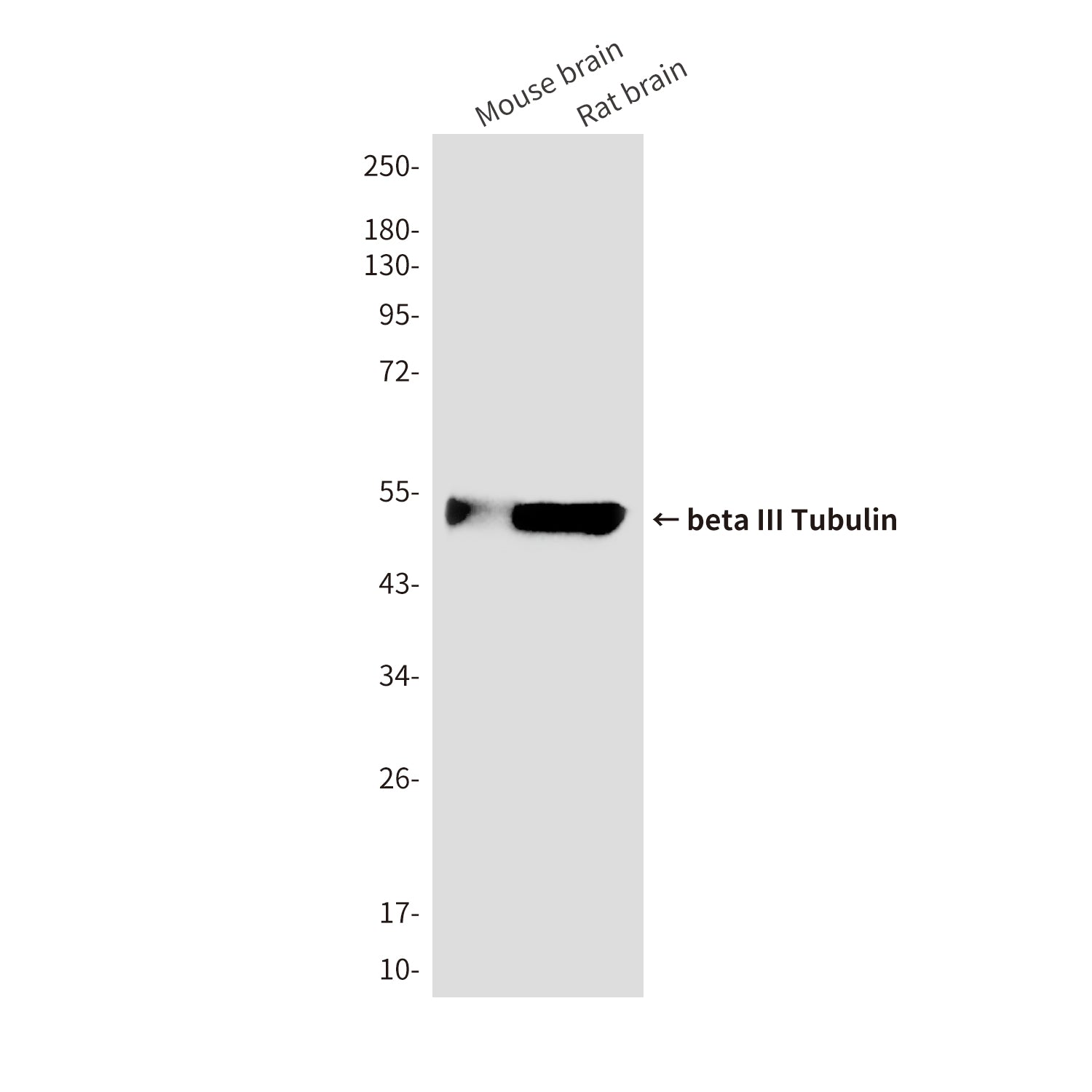 Anti-beta III Tubulin (3H2) Mouse Monoclonal Antibody