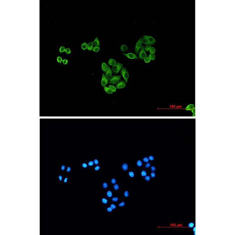 Anti-beta I Tubulin (1H10) Mouse Monoclonal Antibody