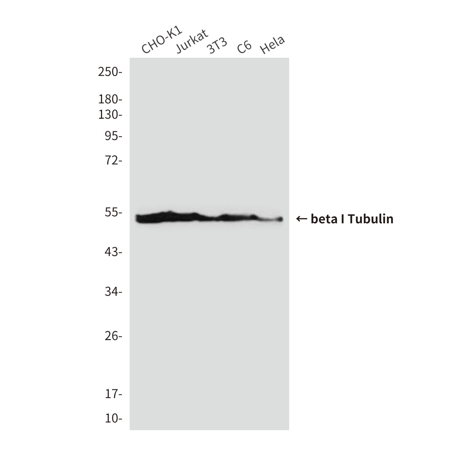 Anti-beta I Tubulin (1H10) Mouse Monoclonal Antibody
