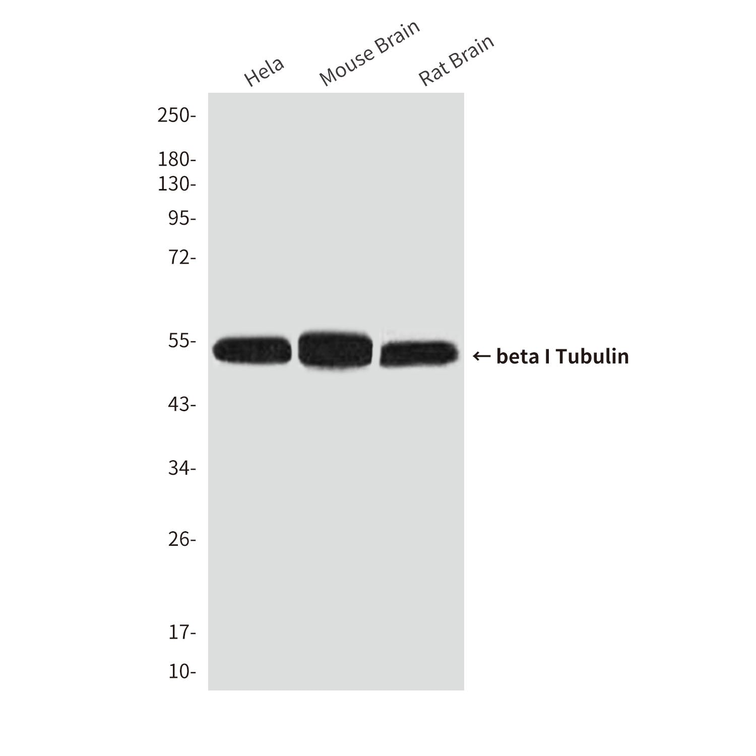 Anti-beta I Tubulin (1H10) Mouse Monoclonal Antibody