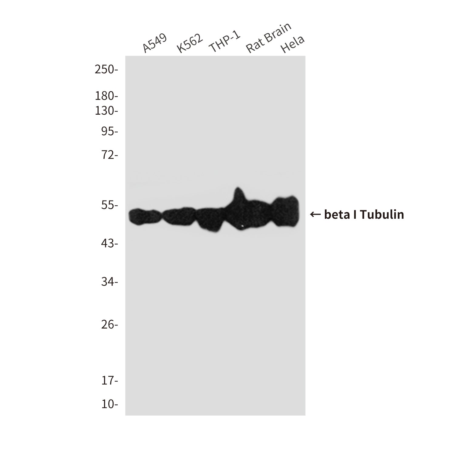 Anti-beta I Tubulin (1H10) Mouse Monoclonal Antibody