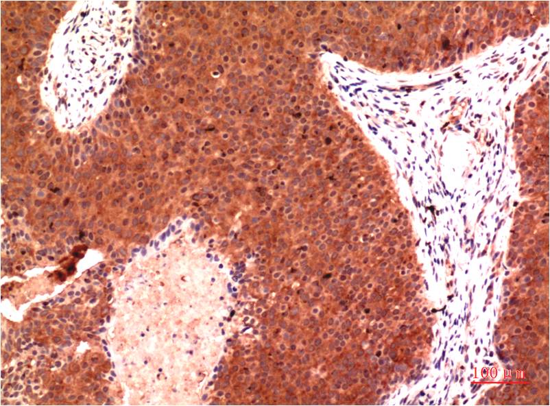 Anti-gamma Tubulin (6A10) Mouse Monoclonal Antibody