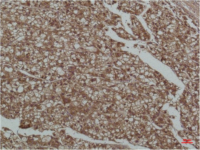 Anti-Smad3 (4H4) Mouse Monoclonal Antibody