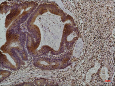 Anti-Smad3 (4H4) Mouse Monoclonal Antibody