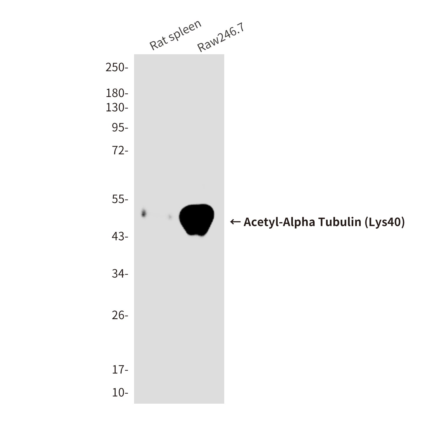 Anti-Acetyl-Alpha Tubulin (Lys40) (6B5) Mouse Monoclonal Antibody