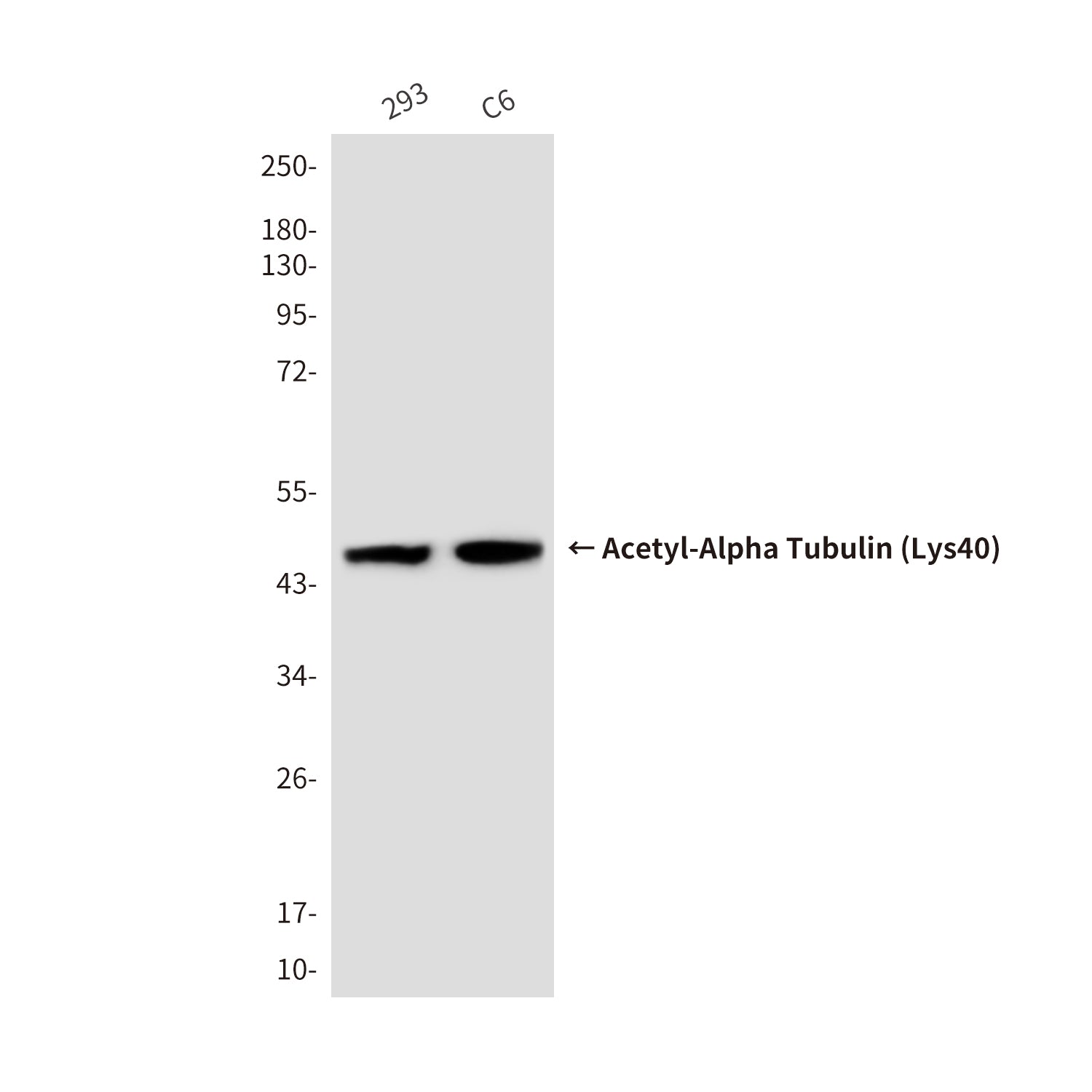 Anti-Acetyl-Alpha Tubulin (Lys40) (6B5) Mouse Monoclonal Antibody