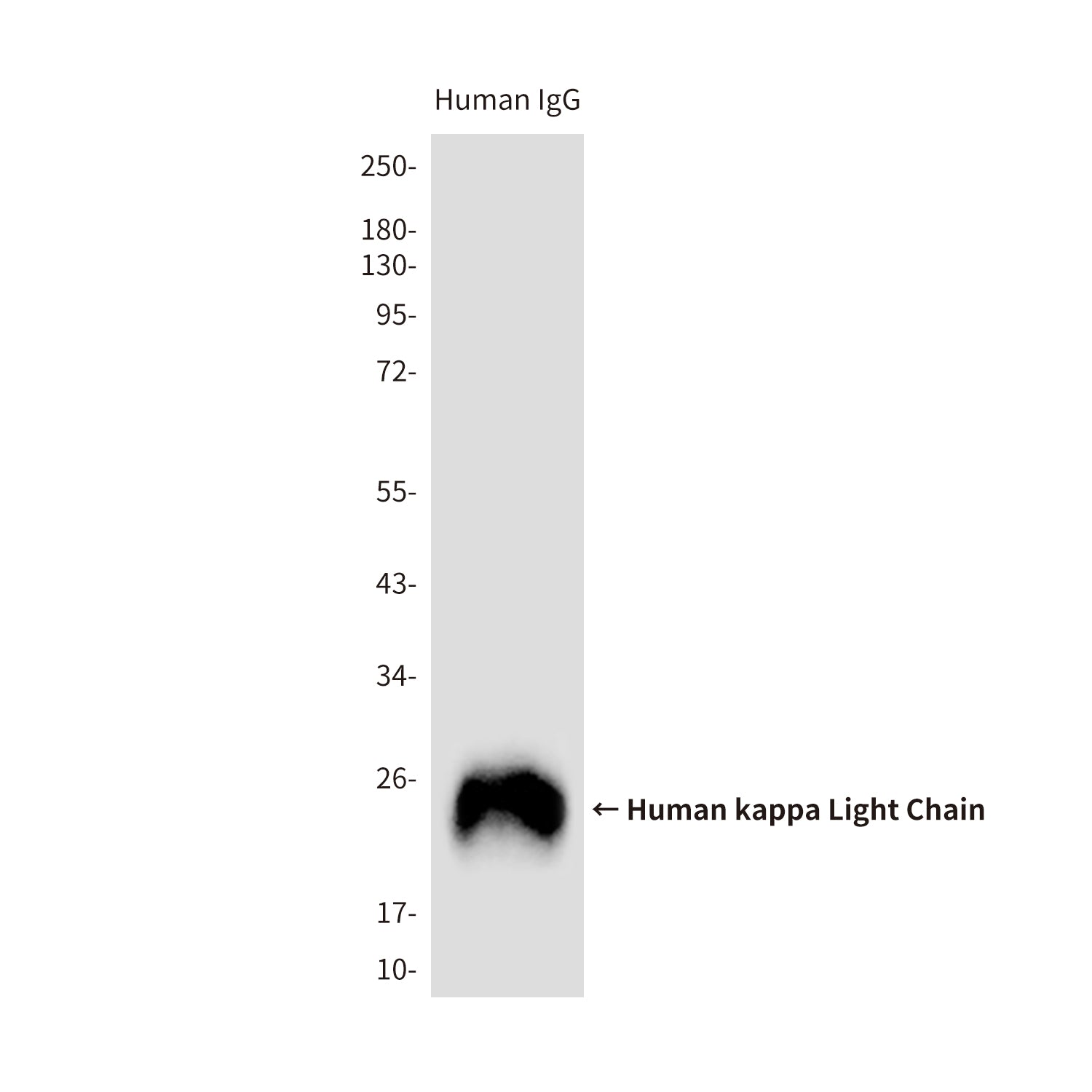 Anti-Human kappa Light Chain Rabbit Polyclonal Antibody