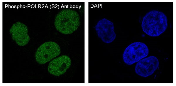 Anti-Phospho-RNA Polymerase II Subunit B1 (Ser2) Rabbit Polyclonal Antibody