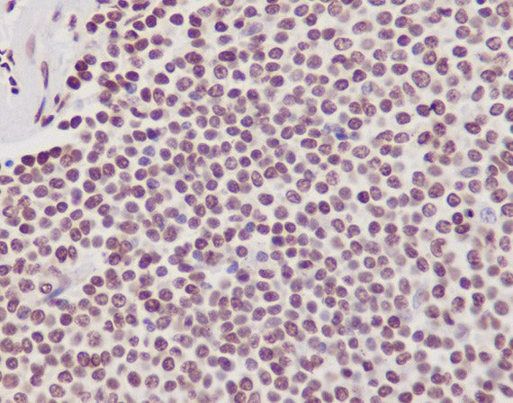 Anti-Phospho-RNA Polymerase II Subunit B1 (Ser2) Rabbit Polyclonal Antibody