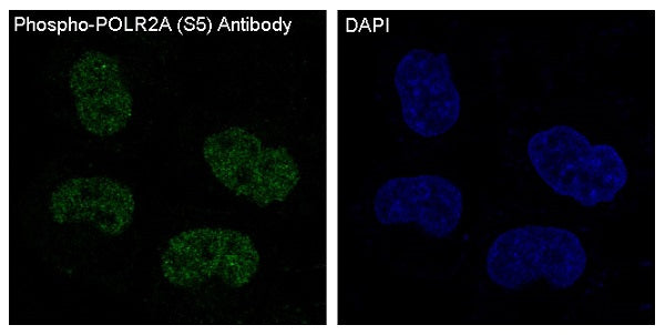 Anti-Phospho-RNA Polymerase II Subunit B1 (Ser5) Rabbit Polyclonal Antibody