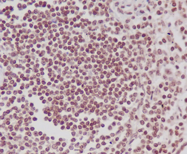 Anti-Phospho-RNA Polymerase II Subunit B1 (Ser5) Rabbit Polyclonal Antibody