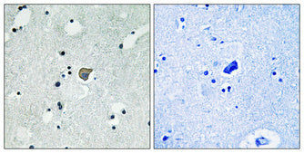 Anti-Phospho-NMDAR2A/2B (Tyr1246/Tyr1252) Rabbit Polyclonal Antibody