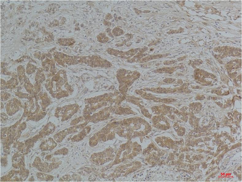 Anti-Acetyl-Alpha Tubulin (Lys40) (9B8) Mouse Monoclonal Antibody