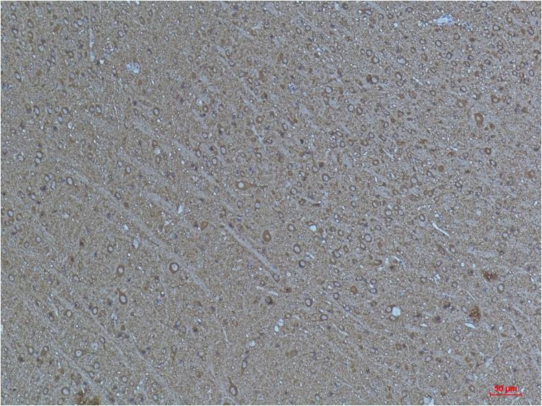 Anti-Acetyl-Alpha Tubulin (Lys40) (9B8) Mouse Monoclonal Antibody