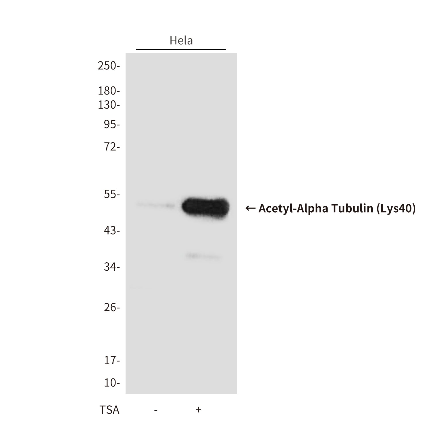 Anti-Acetyl-Alpha Tubulin (Lys40) (9B8) Mouse Monoclonal Antibody