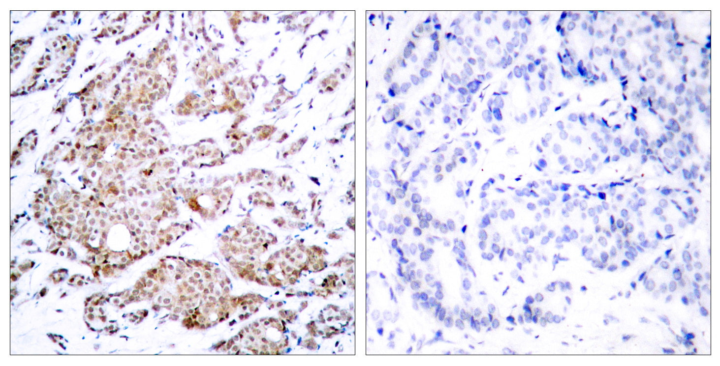 Anti-Phospho-c-Myc (Thr58) Rabbit Polyclonal Antibody