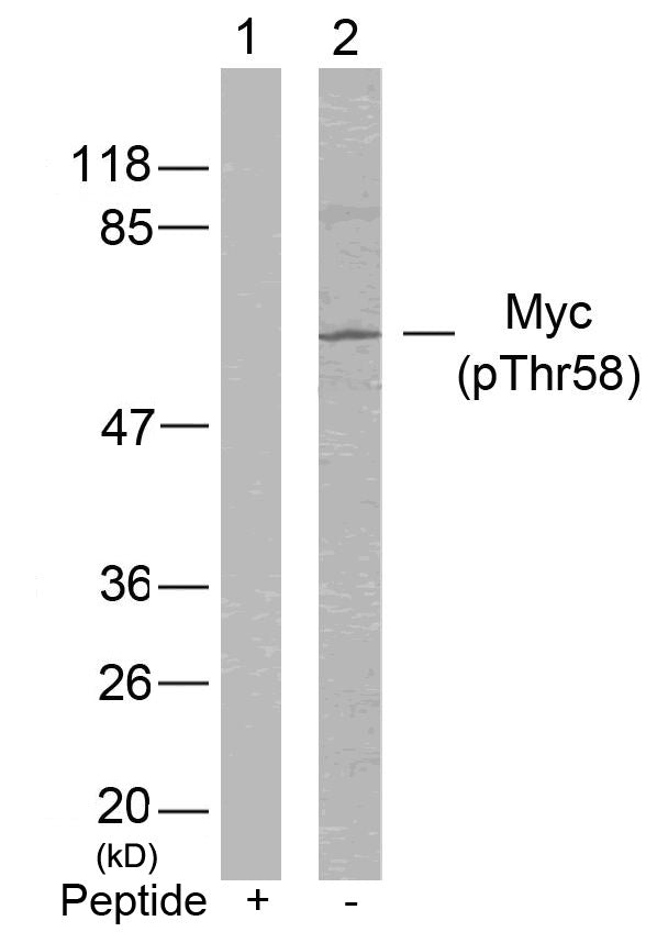 Anti-Phospho-c-Myc (Thr58) Rabbit Polyclonal Antibody