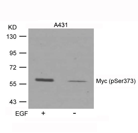 Anti-Phospho-c-Myc (Ser373) Rabbit Polyclonal Antibody