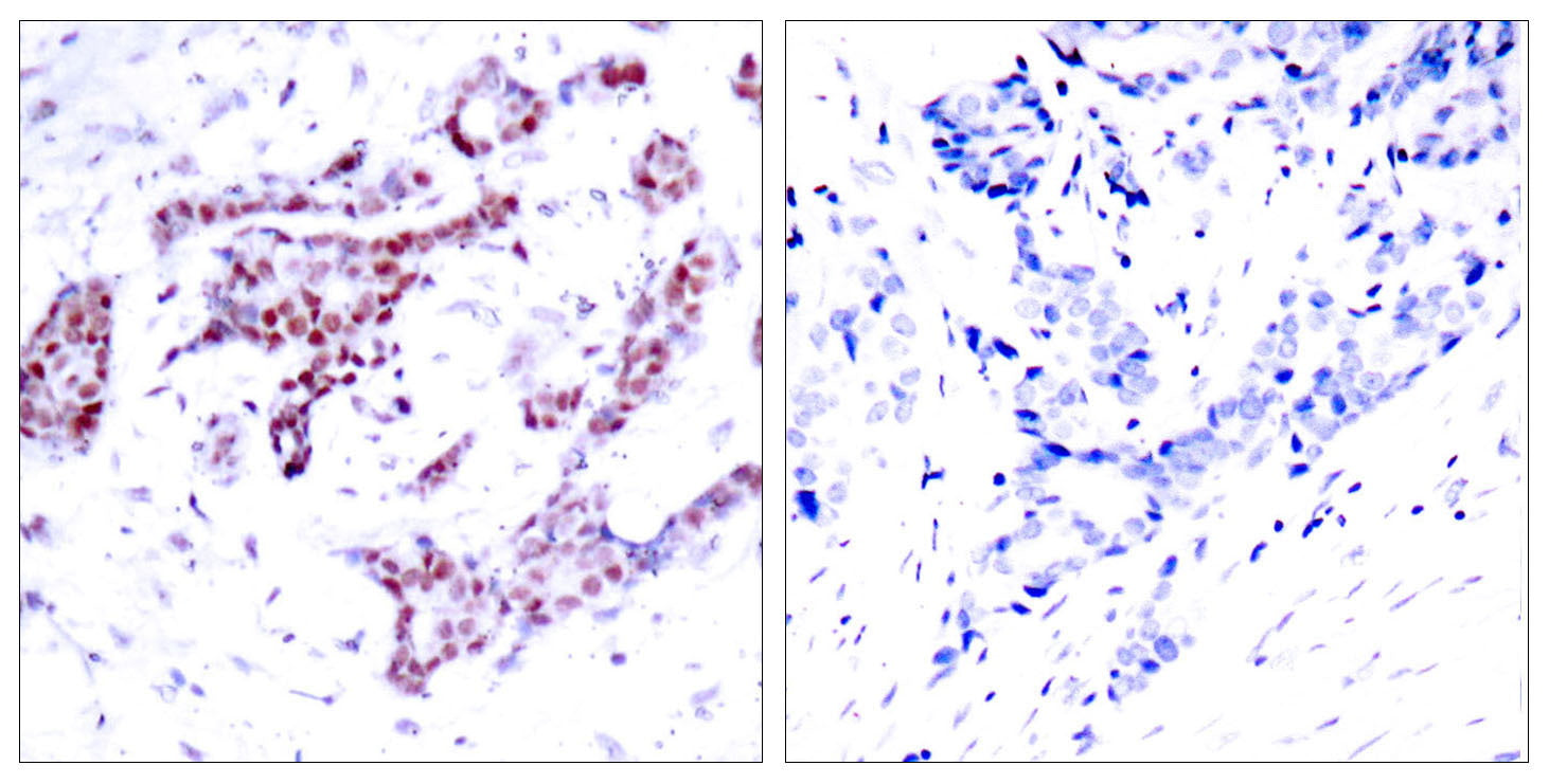 Anti-Phospho-STAT1 (Tyr701) Rabbit Polyclonal Antibody
