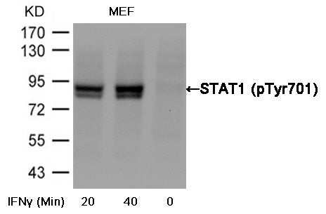 Anti-Phospho-STAT1 (Tyr701) Rabbit Polyclonal Antibody