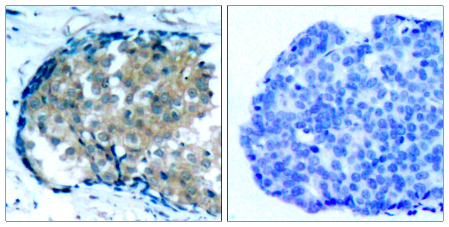 Anti-Phospho-Ezrin (Tyr353) Rabbit Polyclonal Antibody